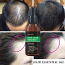 Hair Growth Oil Hair Growth Oil Oem Hair Care Essential Oil - Ehanmart