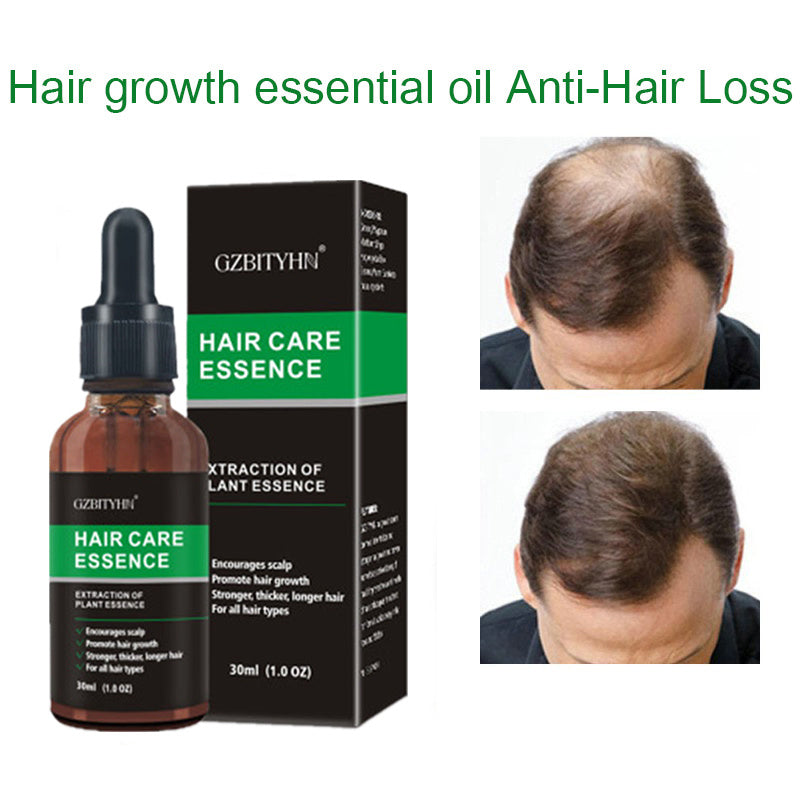 hair-growth-oil-hair-growth-oil-oem-hair-care-essential-oil