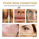 EELHOE Turmeric Dark Spot Correcting Serum Face Care Spot Moisturizing Nourishing Repairing Complexion Serum - Ehanmart