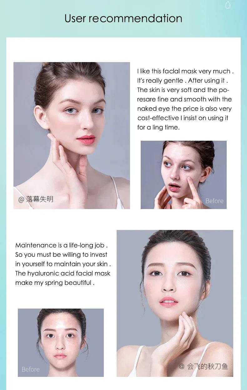 10PCS Hyaluronic Acid Hydrating Facial Mask – Deep Moisturizing & Pore Shrinking Sheet Masks