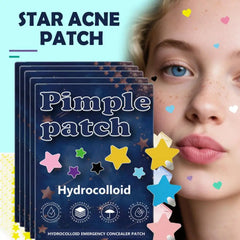 overnight acne treatment star patches